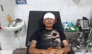 Berhasil Kabur dari Aksi Begal, Tukang Ojek di Cianjur Dapat 32 Jahitan