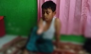 Bocah Korban Sengatan Listrik di Cianjur Butuh Bantuan Dermawan