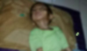 Begini Kondisi Arya Bocah Dua Tahun Pengidap Meningitis di Cikalongkulon Cianjur