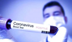 Dampak Virus Corona, Hunian Hotel di Cianjur Turun 35 Persen