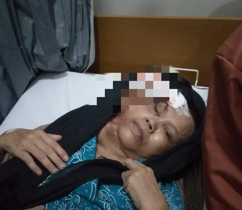 Dinkes Cianjur Ungkap Keterlambatan Penanganan Nurhayati Penderita Tumor Ganas Asal Takokak Cianjur