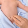 Viral di Media Sosial! Bayi di Brazil Punya 4 Ginjal Pada saat Dilahirkan di Rumah Sakit