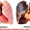 perbandingan-paru-paru-perkok.jpg