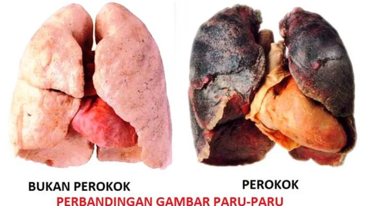 perbandingan-paru-paru-perkok.jpg